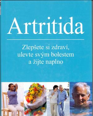 Artritida Artritida